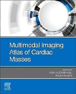 Multimodel Imaging Atlas of Cardiac Masses